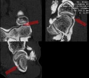 CT-Thorax