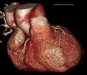 Kardio-CT