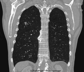 CT-Thorax